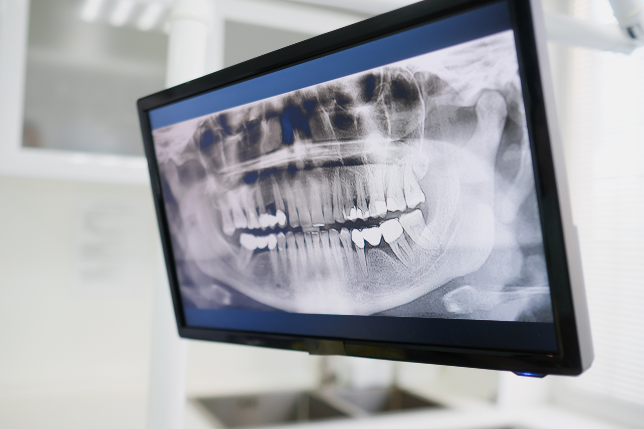 dentysta gdańsk